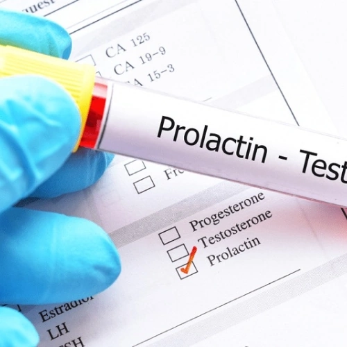 Xét nghiệm Prolactin
