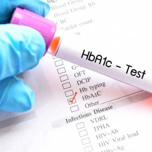 Định lượng HbA1c