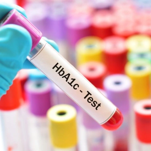 Định lượng Glucose máu và HbA1c