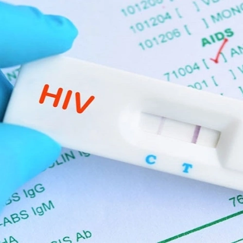 HIV Ab test nhanh