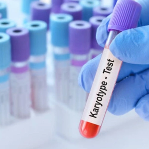Công thức nhiễm sắc thể (Karyotype) máu ngoại vi
