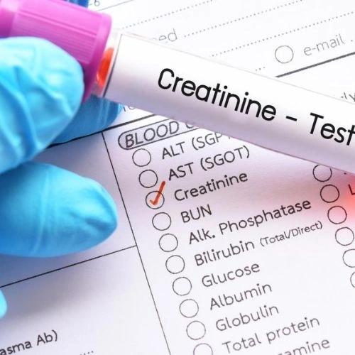 Định lượng Urê máu, Creatinin máu