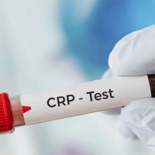 Định lượng CRP-hs