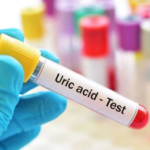 Định lượng Acid Uric