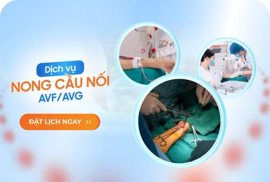 Dịch vụ Nong cầu nối AVF/AVG