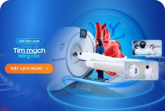 Gói khám tầm soát bệnh lý tim mạch nâng cao