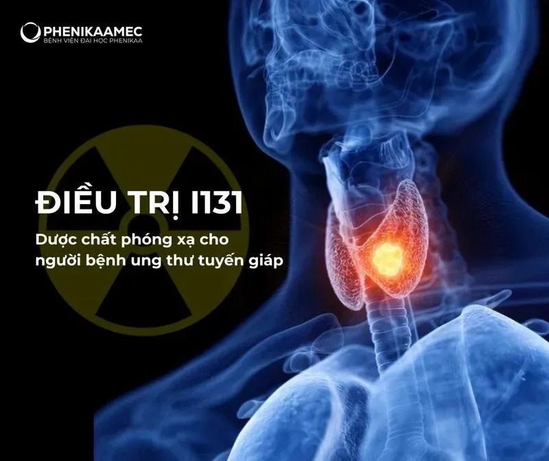 Sắp thêm một địa chỉ điều trị ung thư tuyến giáp bằng I131 tại Hà Nội