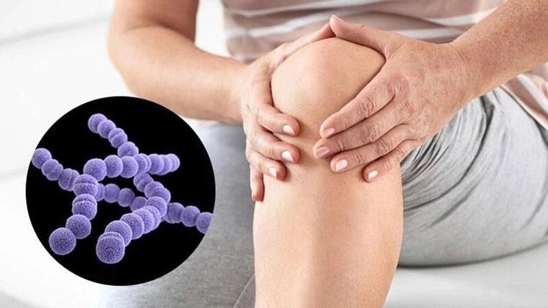 Viêm khớp liên cầu là gì? Dấu hiệu, nguyên nhân, chẩn đoán, cách điều trị và phòng bệnh