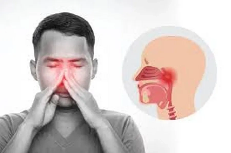 Top 6 nguyên nhân ung thư vòm họng và cách phòng ngừa hiệu quả 