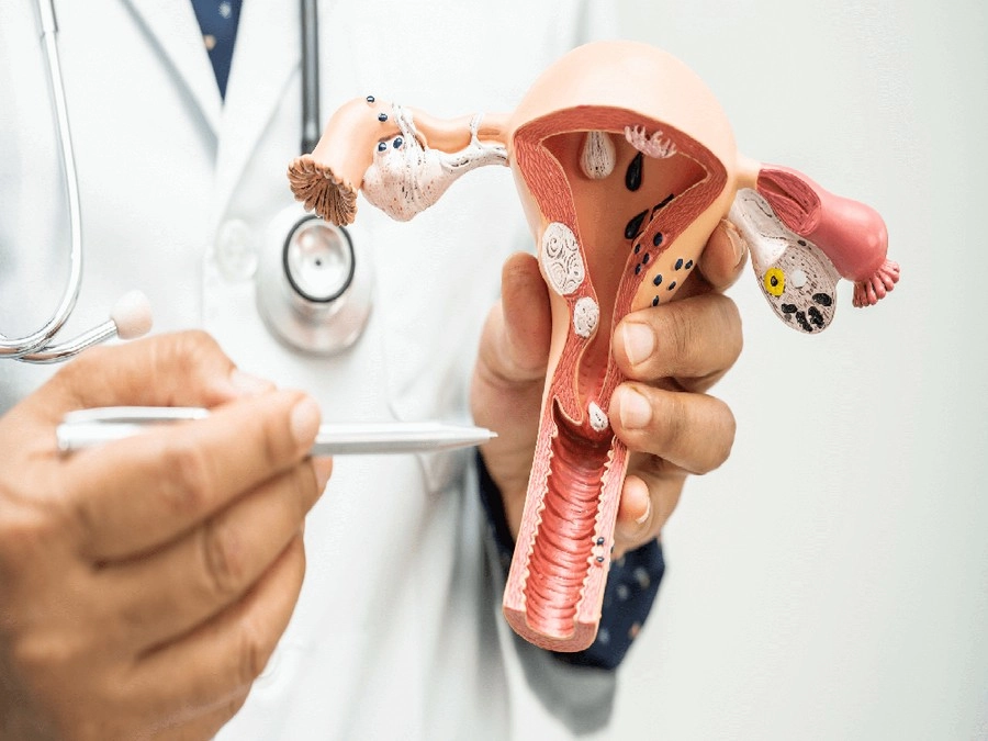 Nang Naboth cổ tử cung: Nguyên nhân, dấu hiệu nhận biết, hướng xử trí và cách phòng ngừa