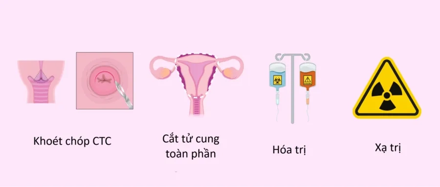 Ung thư cổ tử cung có chữa được không? Tìm hiểu chi tiết phương pháp điều trị, chi phí và tiên lượng sống