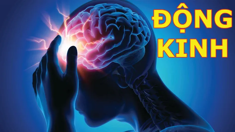 Động kinh là bệnh gì? Triệu chứng, nguyên nhân, chẩn đoán, cách điều trị và phòng bệnh ra sao?