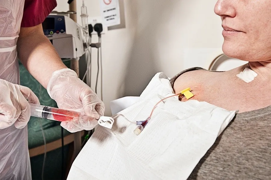 Hóa trị ung thư vú: Phác đồ, tác dụng phụ và cách chăm sóc hiệu quả