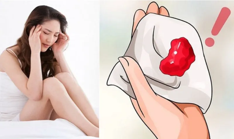 Xuất huyết tử cung bất thường là gì? Dấu hiệu, nguyên nhân, chẩn đoán, cách điều trị và phòng bệnh