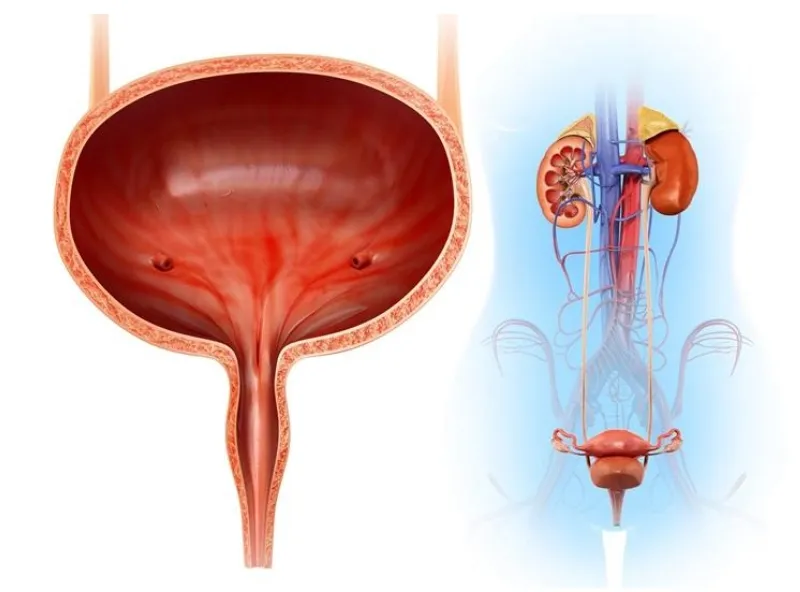 Viêm bàng quang kẽ là gì? Dấu hiệu, nguyên nhân, chẩn đoán, cách điều trị và phòng bệnh