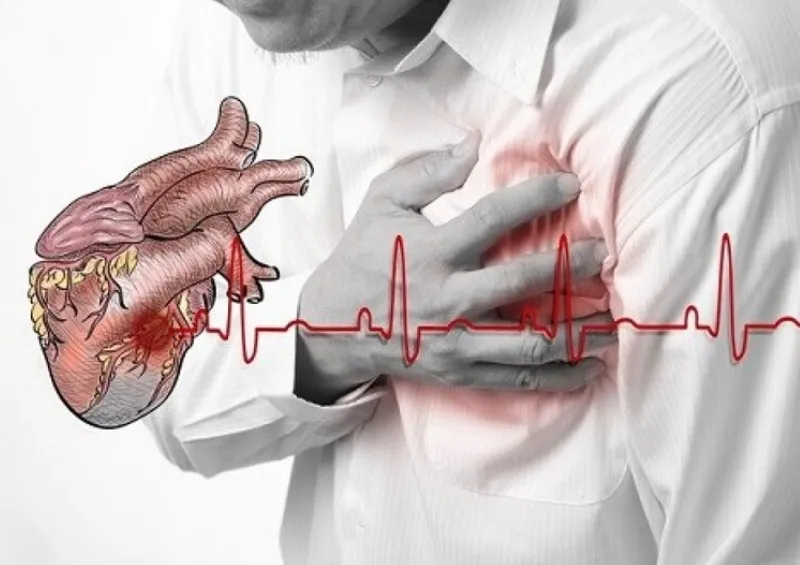 Nhồi máu cơ tim là gì? Dấu hiệu, nguyên nhân, chẩn đoán, cách điều trị và phòng bệnh