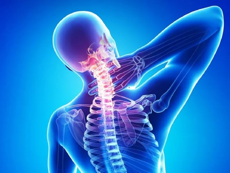 Thoái hóa đốt sống cổ là gì? Dấu hiệu, nguyên nhân, chẩn đoán, cách điều trị và phòng bệnh