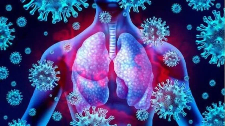 Viêm phổi do virus là gì? Nguyên nhân, triệu chứng, chẩn đoán và điều trị