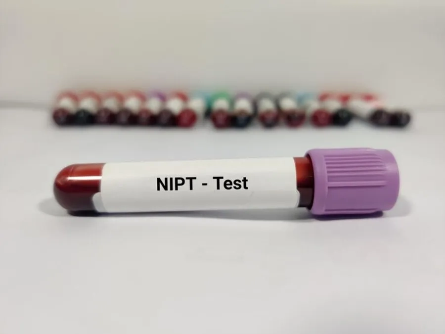 Những điều mẹ bầu cần biết về gói xét nghiệm sàng lọc NIPT 3