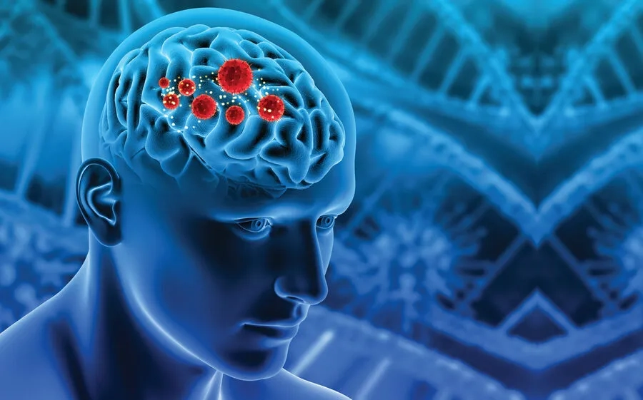 Viêm màng não là gì? Nguyên nhân, triệu chứng và cách điều trị hiệu quả