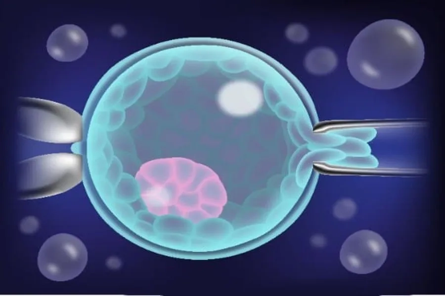 Sinh thiết phôi là gì? Có tác dụng gì? Chi phí bao nhiêu tiền? Chuyên gia phôi học giải đáp