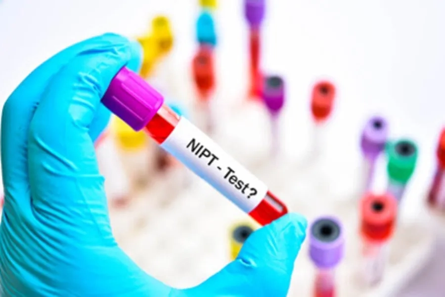 Xét Nghiệm NIPT Có Phát Hiện Tim Bẩm Sinh Không? Những Điều Mẹ Cần Biết