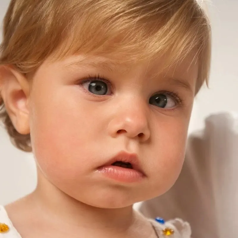 Lác mắt bẩm sinh có chữa khỏi được không?