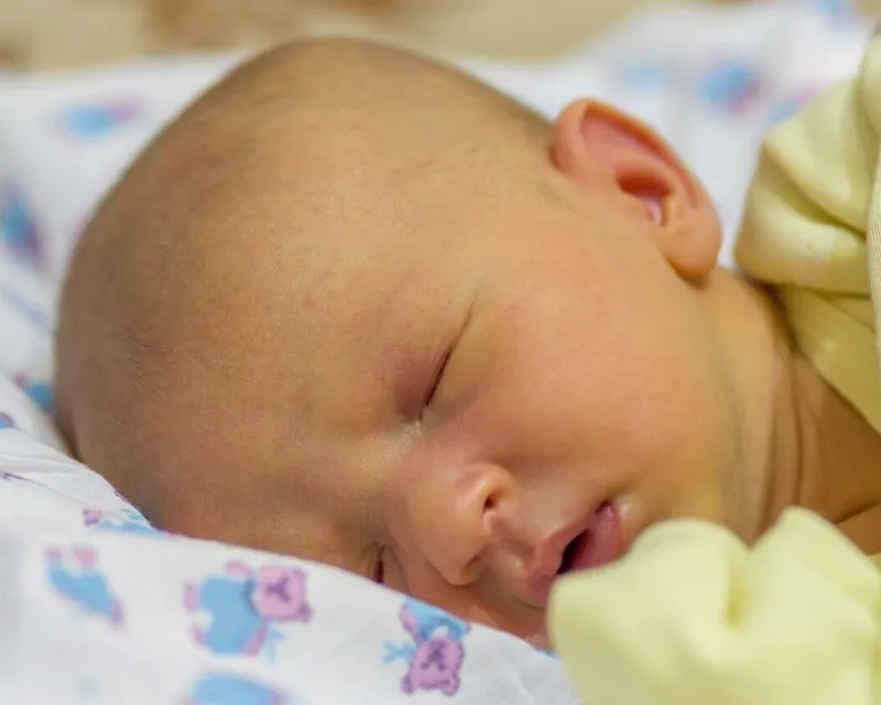 Sau khi chiếu đèn bé vẫn bị vàng da phải làm sao?