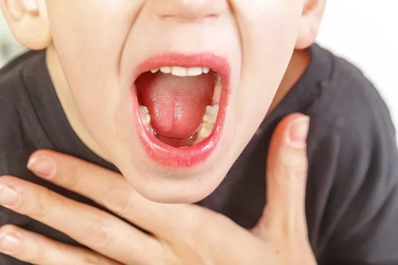 Trẻ bị viêm amidan sốt mấy ngày