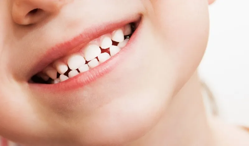 Trẻ mấy tuổi thì thay răng sữa?