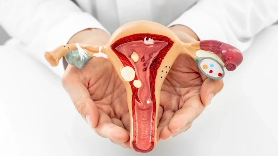 Tử cung có vách ngăn: Nguyên nhân, triệu chứng và cách điều trị 