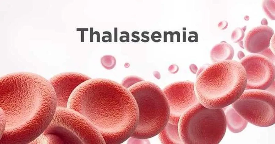 [Chuyên Gia Giải Đáp] Bệnh Thalassemia Có Di Truyền Không? 