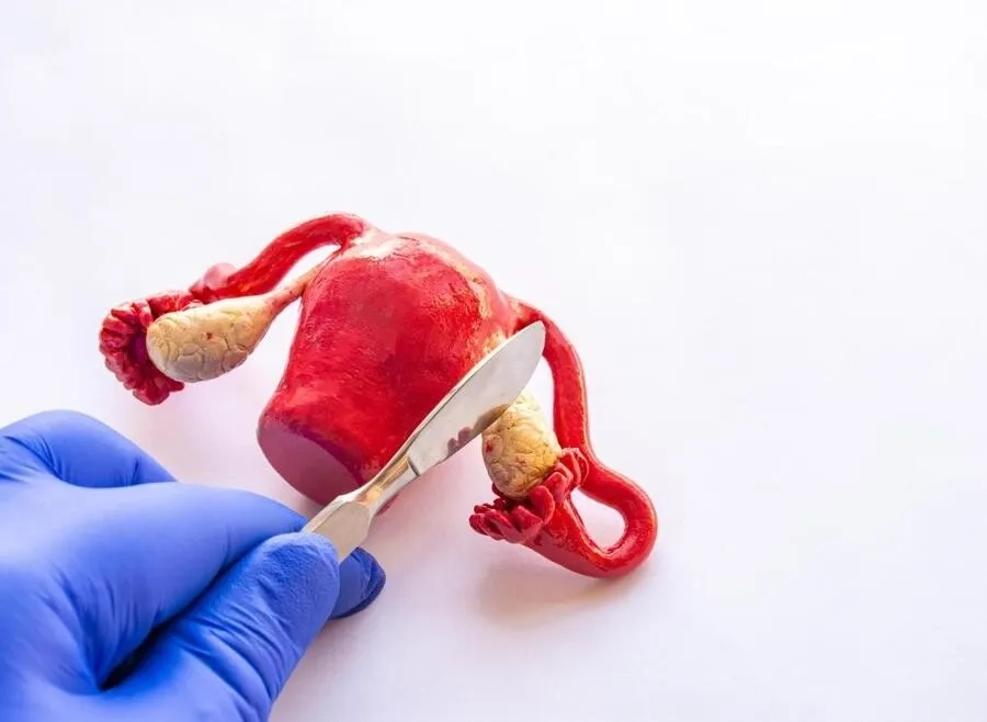 Cắt buồng trứng có kinh không và cơ thể sẽ thay đổi ra sao?