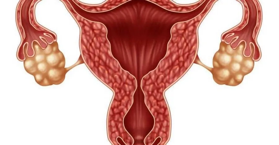 Nang buồng trứng là gì? Sự phát triển và các phương pháp đánh giá số lượng nang