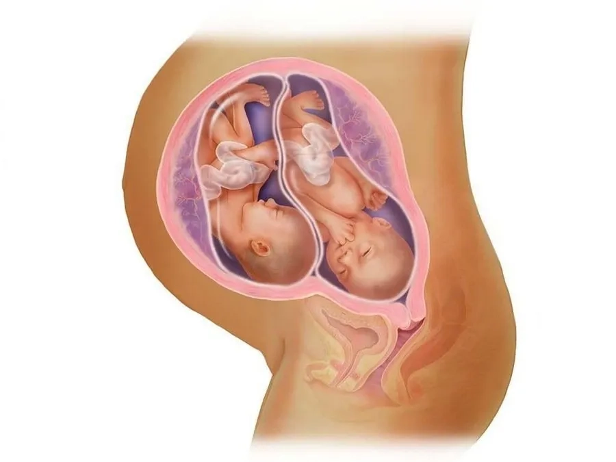 Mang Song Thai 2 Nhau 2 Ối: Những Điều Mẹ Bầu Cần Biết