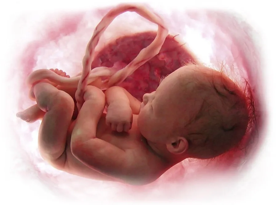 Truyền Máu Cuống Rốn Là Gì? Có Nguy Hiểm Không? Chuyên Gia Giải Đáp
