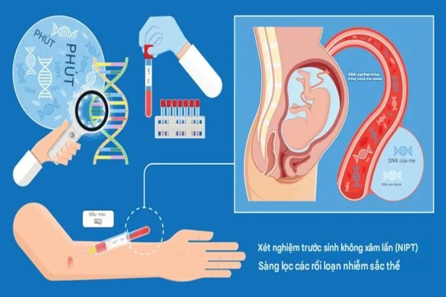 Xét nghiệm NIPT là gì? Quy trình, chi phí và thời điểm thực hiện