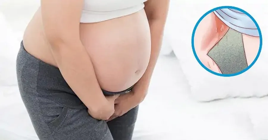 Khắc Phục Thiểu Ối 3 Tháng Đầu: Nguyên Nhân, Cách Xử Lý An Toàn Cho Mẹ Bầu 