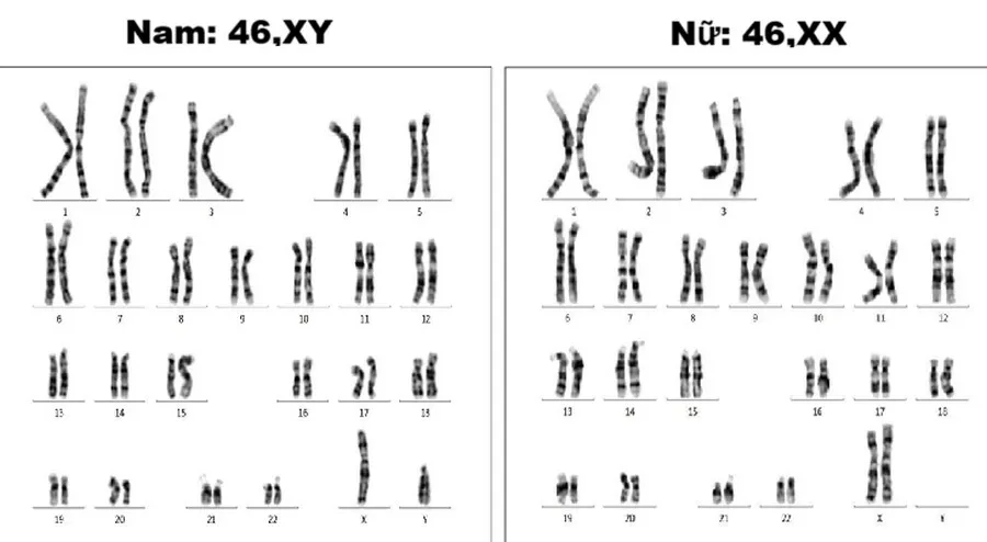 Vì sao không có xét nghiệm sàng lọc NIPT 24 cặp nhiễm sắc thể? 