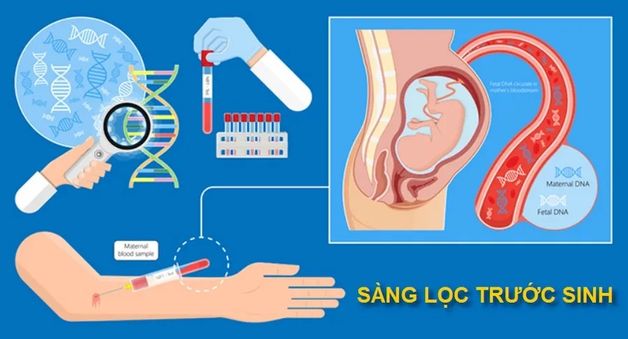 Sàng lọc trước sinh là gì? Tổng hợp phương pháp, quy trình, cách đọc kết quả sàng lọc trước sinh 