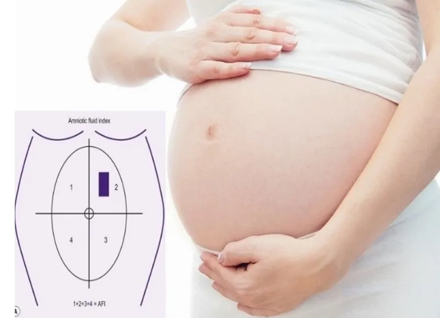 Góc ối sâu nhất bao nhiêu là bình thường? Chỉ số MVP từ 2-6cm được cho là lý tưởng. Tìm hiểu dấu hiệu thiểu ối, đa ối và cách xử trí an toàn cho mẹ bầu.