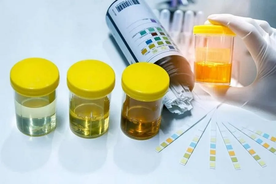 Nước Ối Có Màu Gì? Cảnh Báo Màu Sắc Bất Thường Mẹ Bầu Cần Biết