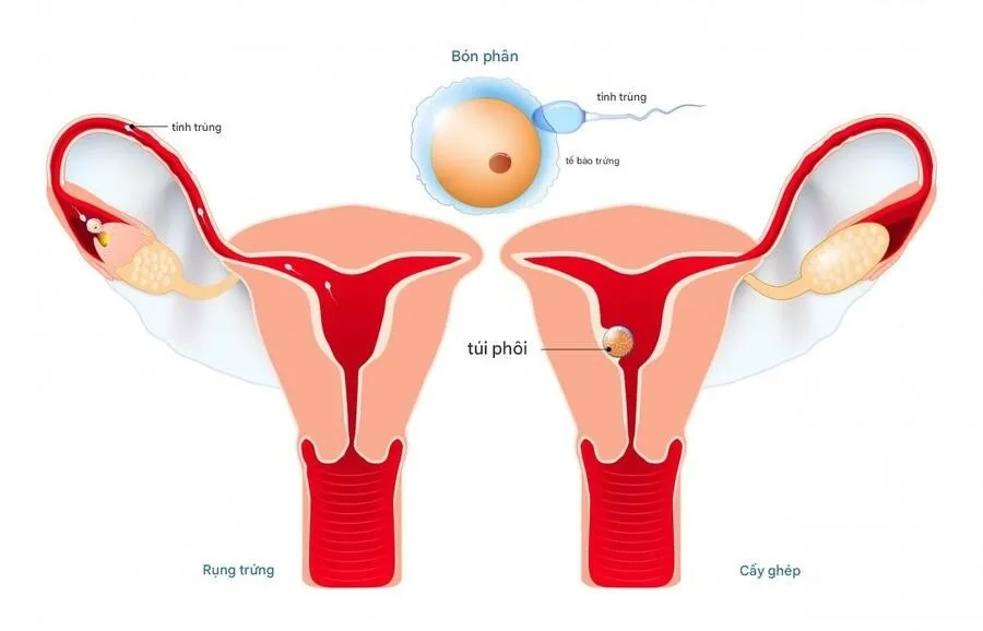 Dấu hiệu thai làm tổ và bí quyết chăm sóc an toàn cho mẹ và bé