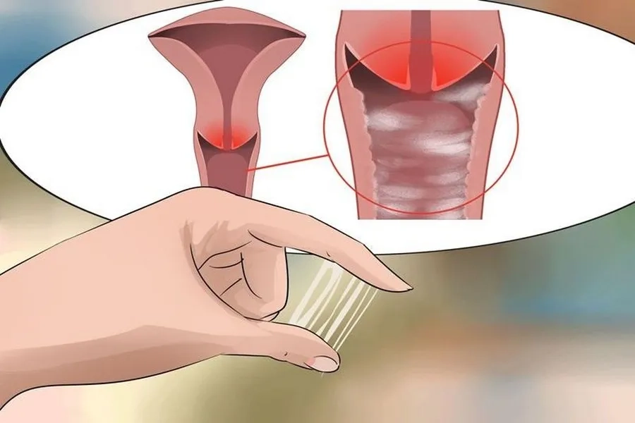 Hướng dẫn cách nhận biết nước ối và huyết trắng qua 4 dấu hiệu đơn giản nhưng ít người biết