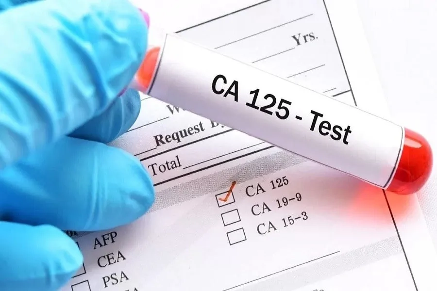 Chỉ số CA-125 tăng cao có thể cảnh báo bất thường ở buồng trứng