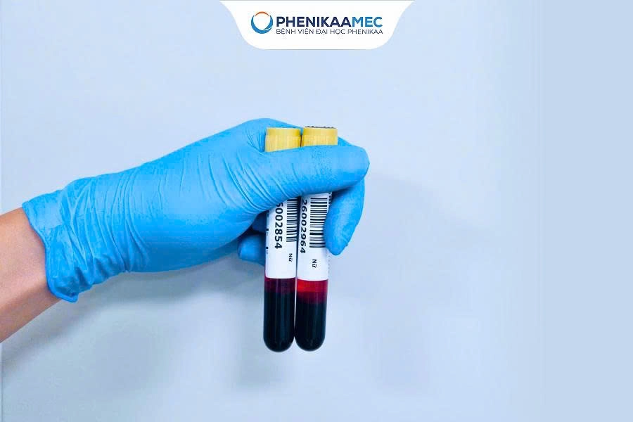 Xét Nghiệm NIPT Có Cần Thiết Không