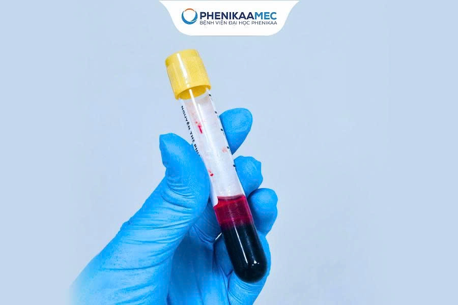 Xét nghiệm NIPT ở đâu