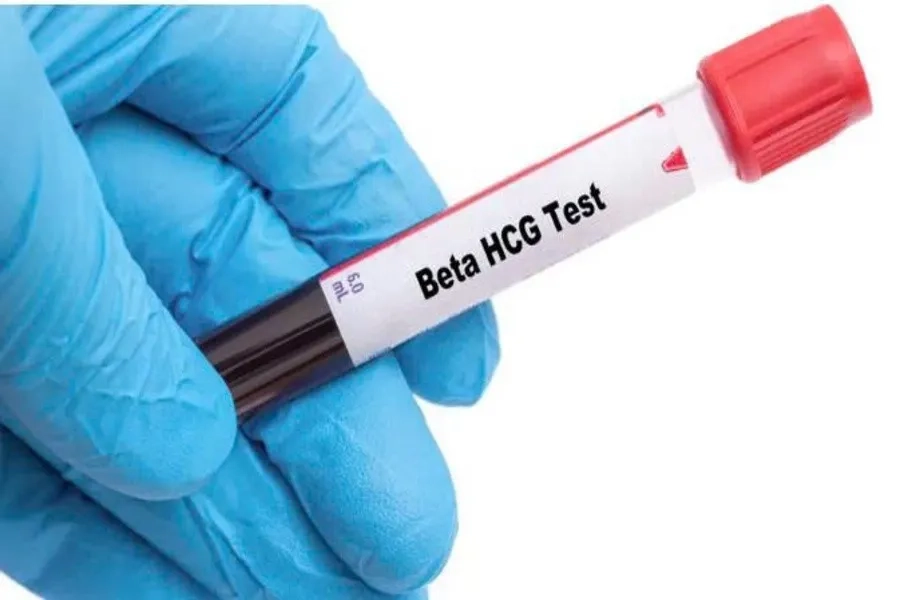 Bạn nên thực hiện xét nghiệm beta hCG để đánh giá kết quả có mang thai hay không