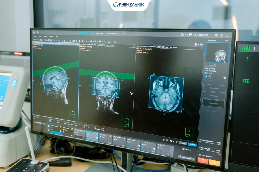 Bệnh viện Đại học Phenikaa chính thức vận hành hệ thống Cộng hưởng từ 3 Tesla Philips Ingenia Elition X