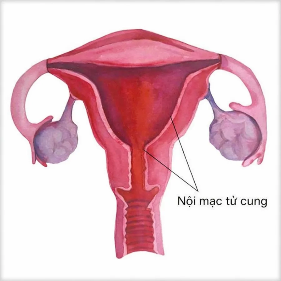 Độ dày nội mạc tử cung không cố định, mà thay đổi theo từng giai đoạn của chu kỳ kinh nguyệt